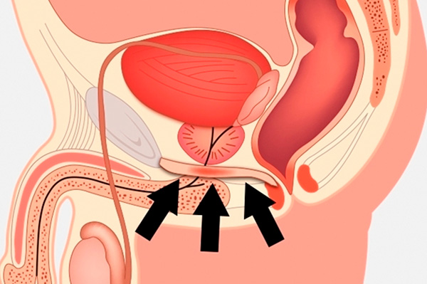 fisioterapia-pelvica-01